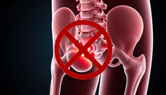 Slip fri af smerterne: forstå din discus prolaps og find lindring
