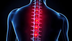 Neuropatiske smerter ved spinalstenose: forståelse og lindring