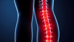 Slip smerterne: få bugt med lændesmerter der stråler ned i benene