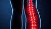 Slip smerterne: få bugt med lændesmerter der stråler ned i benene