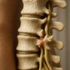 Osteofytter i ryggen: vejen til lindring og øget bevægelighed