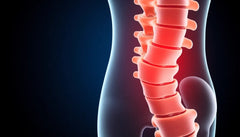 Effektive øvelser til lindring af diskusprolaps i L5/S1-regionen